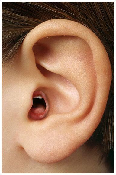 tinitus, retusch. öra, mun